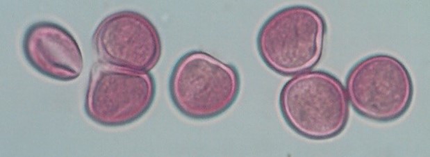 Immagine tratta dal documento LA CONGIUNTIVITE ALLERGICA
